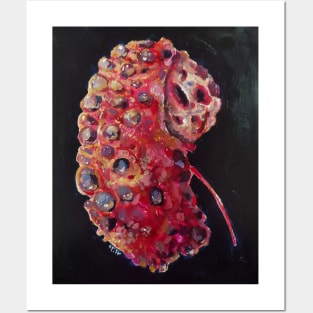 kidney disease Posters and Art